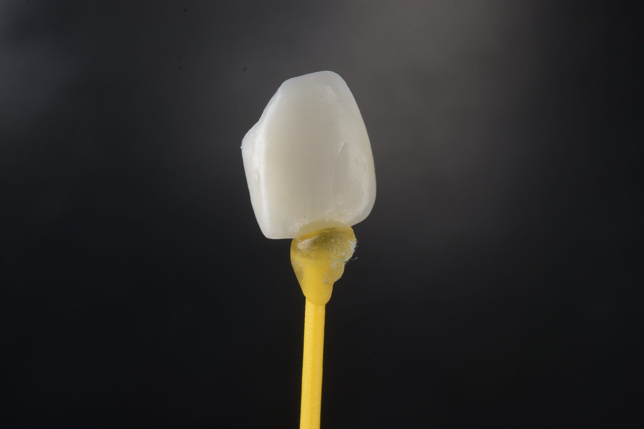 Chicago dental crowns