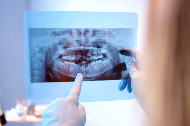 TMJ Therapy in Chicago