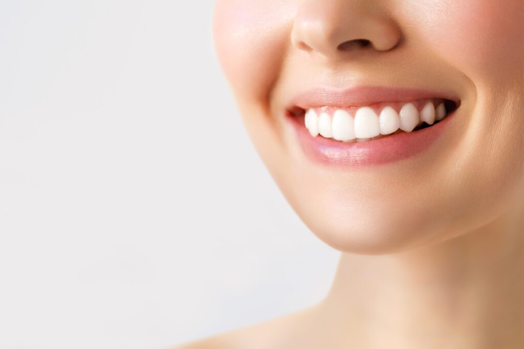 professional Teeth Whitening in Chicago